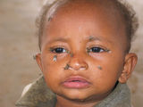 Дете от Еритрея ; comments:2